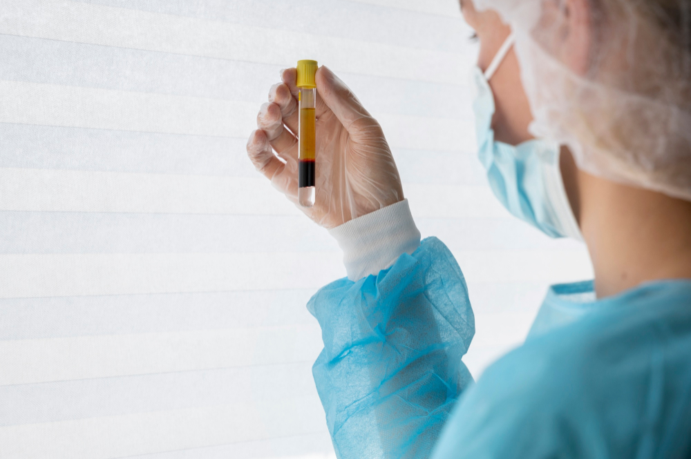 Best PRP Treatment in Bangalore